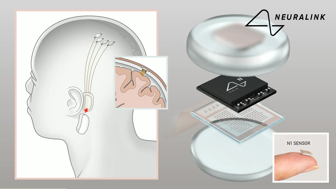Neuralink
